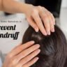 5 Effective Home Remedies to Prevent Dandruff