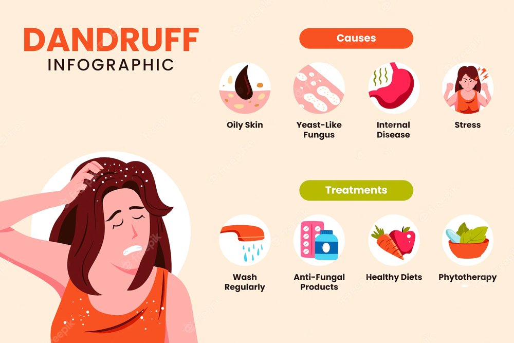 5-Effective-Home-Remedies-to-Prevent-Dandruff image