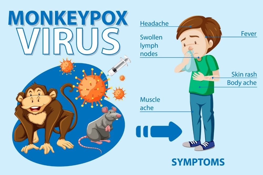 How China Manages Monkeypox - A Comprehensive Overview and Symptoms