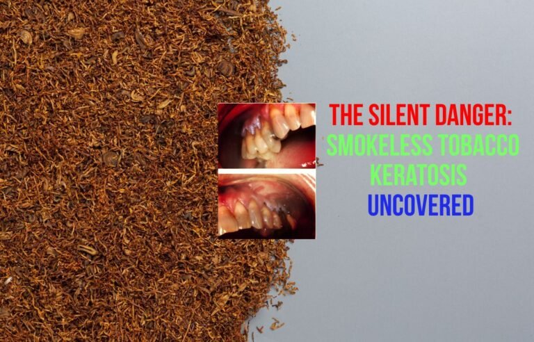 The Silent Danger Smokeless Tobacco Keratosis Uncovered